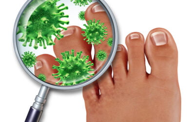 Toenail Fungus: Here is Everything You Need to Know